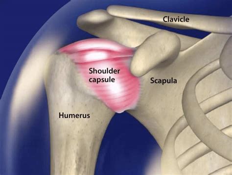 Prospective outcome data was collected from patients who underwent <b>arthroscopic</b> débridement and <b>capsular</b> <b>release</b> for painful idiopathic glenohumeral arthritis from 2005 to 2013 by one surgeon. . Arthroscopic capsular release shoulder cpt code